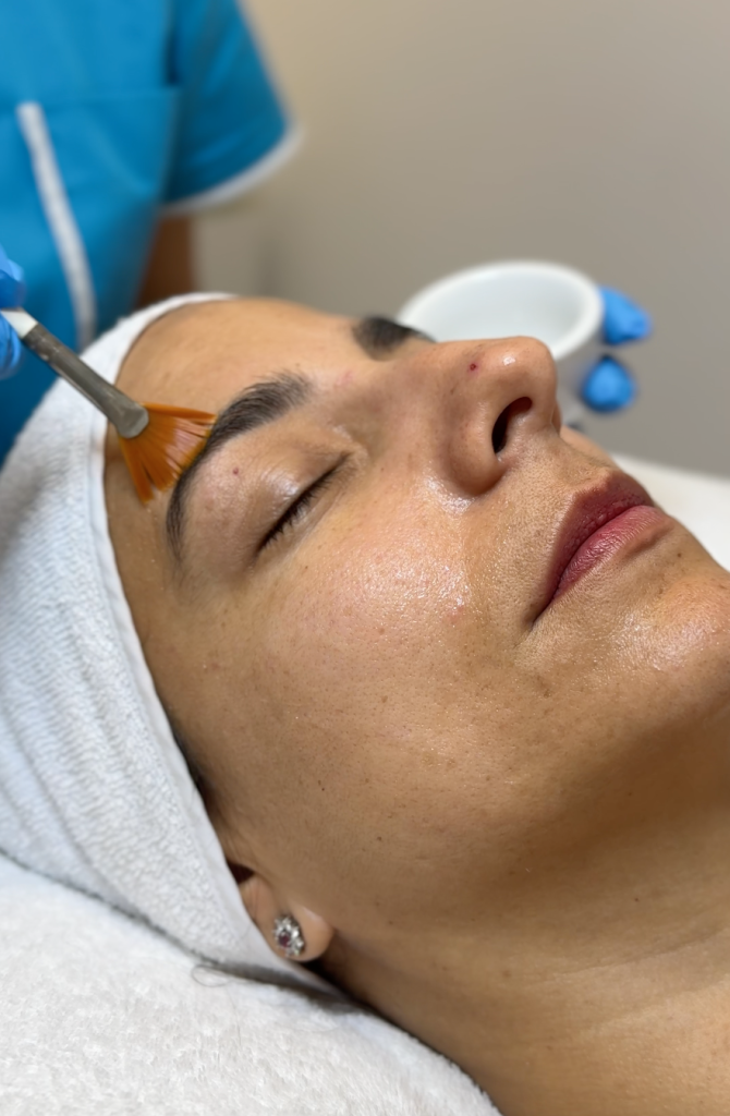 Orion XPro: rejuvenecimiento facial inmediato
