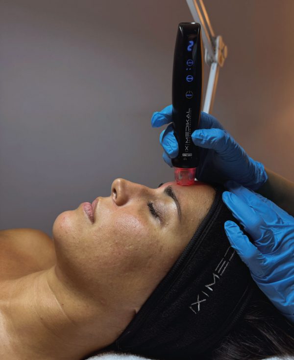 Orion XPro: rejuvenecimiento facial inmediato