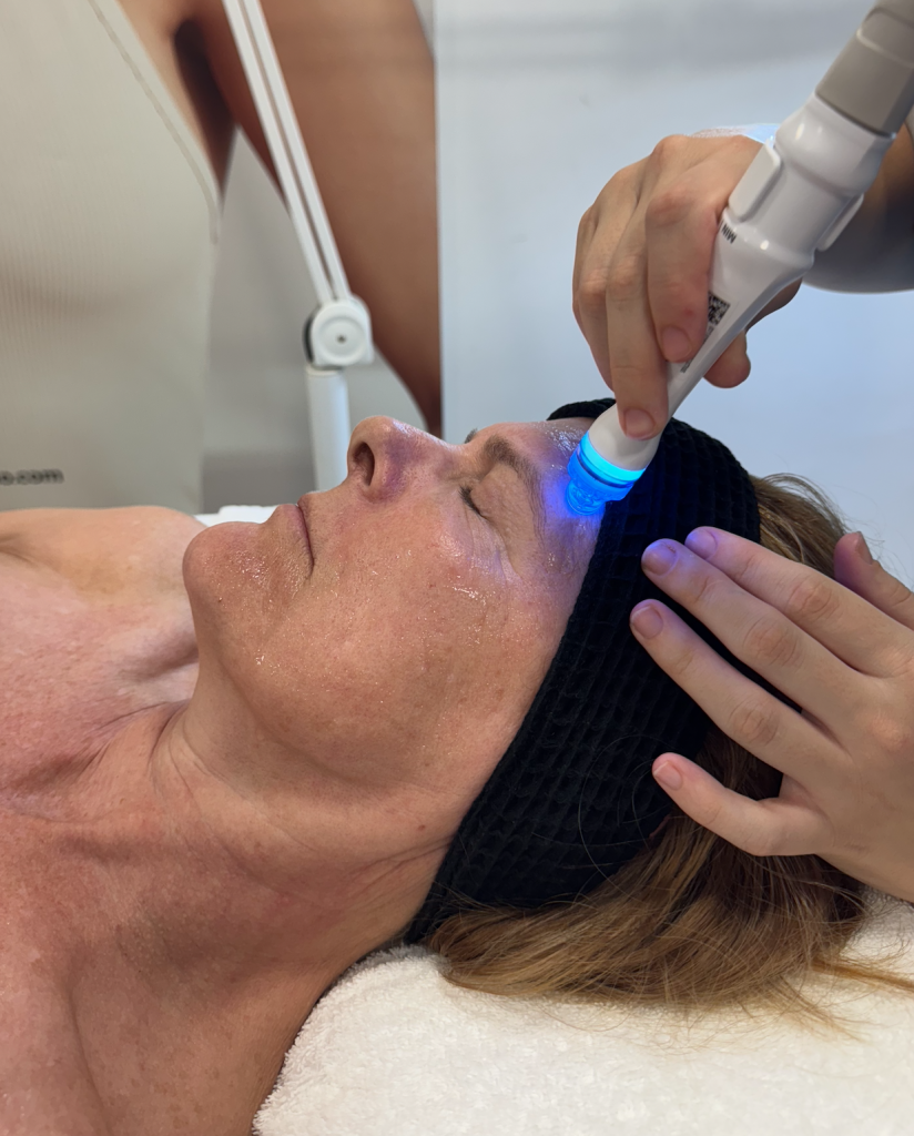 Cómo recuperar la piel después del verano en Sevilla 3 AQUAPURE - Tratamiento facial avanzado para devolverle a tu piel su vitalidad natural