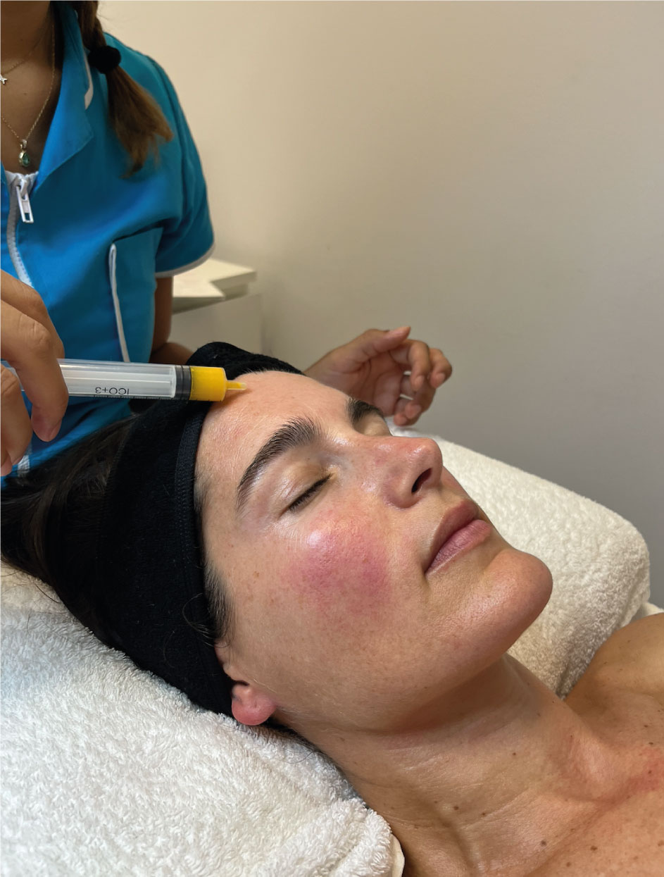 PROXN | Tratamiento para pieles sensibles | Rosácea, dermatitis, acné, manchas, etc. 2 PROXN | Tratamiento para pieles sensibles | Rosácea, dermatitis, acné, manchas, etc. - Imagen 2