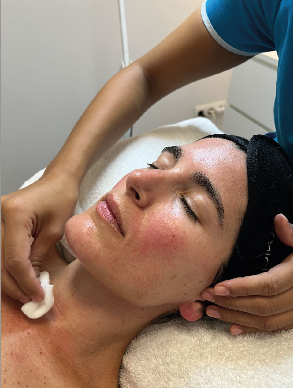 PROXN | Tratamiento para pieles sensibles | Rosácea, dermatitis, acné, manchas, etc. 5 PROXN | Tratamiento para pieles sensibles | Rosácea, dermatitis, acné, manchas, etc. - Imagen 5