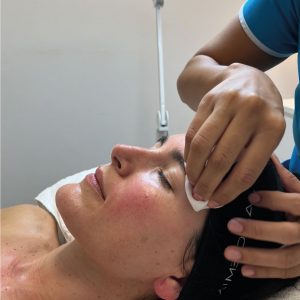 PROXN | Tratamiento para pieles sensibles | Rosácea, dermatitis, acné, manchas, etc.